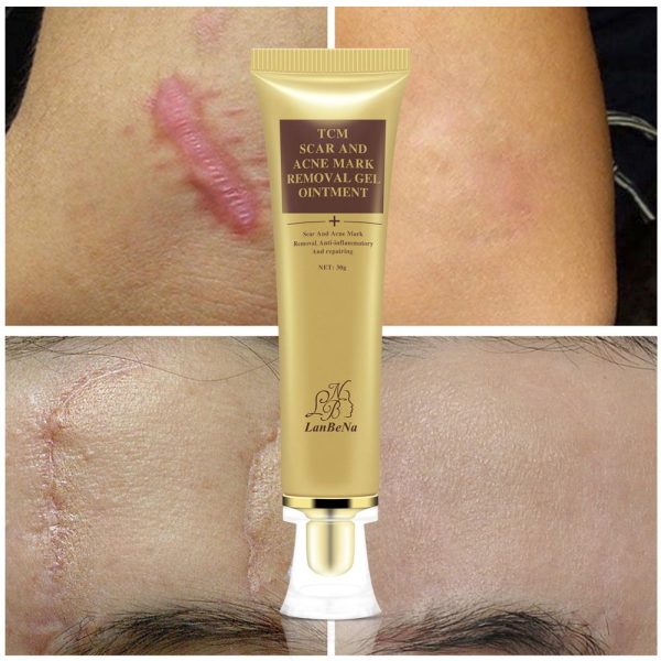 Lanbena-acne-scar-removal-cream-shopandshop-5-600x600