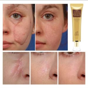 ژل ترمیم کننده پوست لانبنا