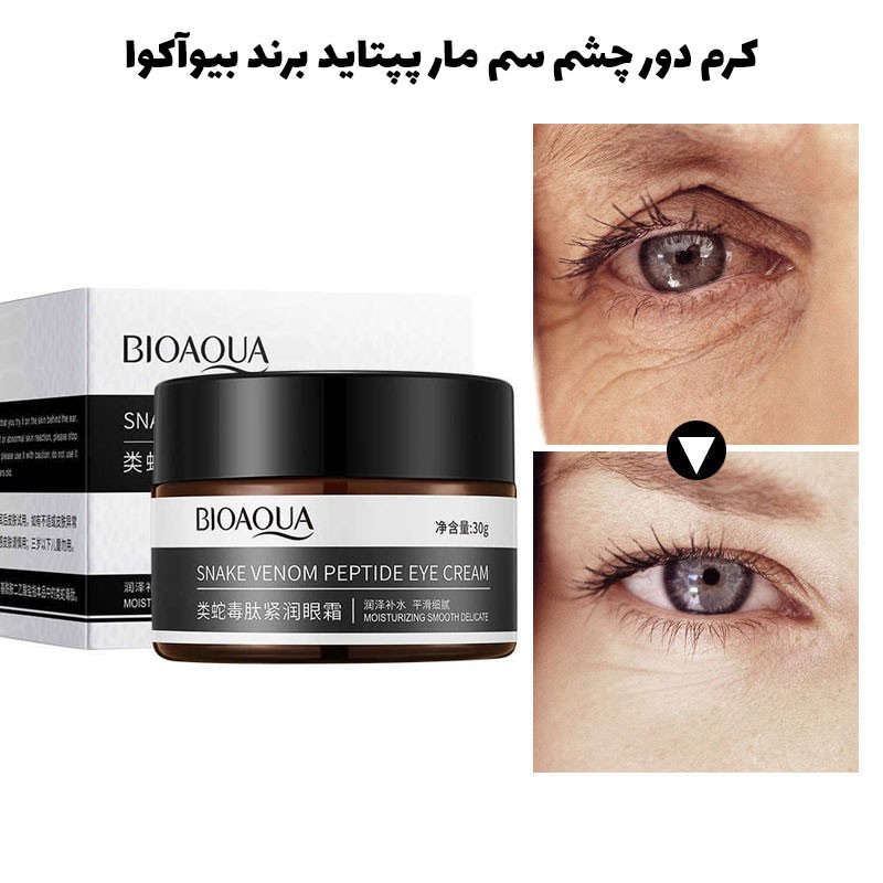 EWhGiuQenpBWKrq3wu6Axie10qzfzYauV1loPATj کرم دور چشم سم مار بایوآکوا