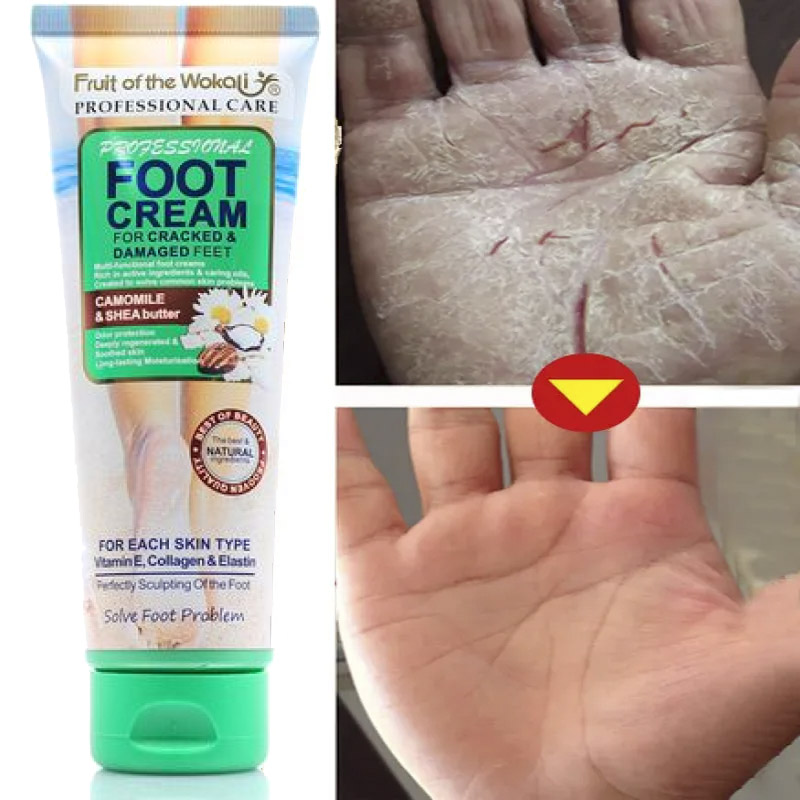 Anti_Crack_Hand_Foot_Cream_Anti_Drying_Heel_Cracked_Repair_Feet (2) کرم رفع ترک پا و دست