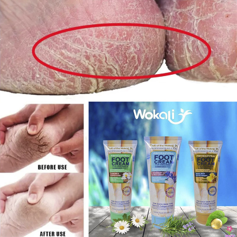 Herbal_Anti_Crack_Foot_Cream_Anti_Drying_Anti_Freeze_Crack_Feet