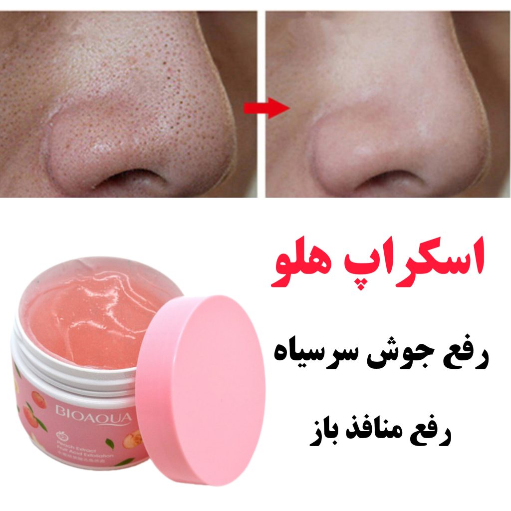 لایه بردار کره ای