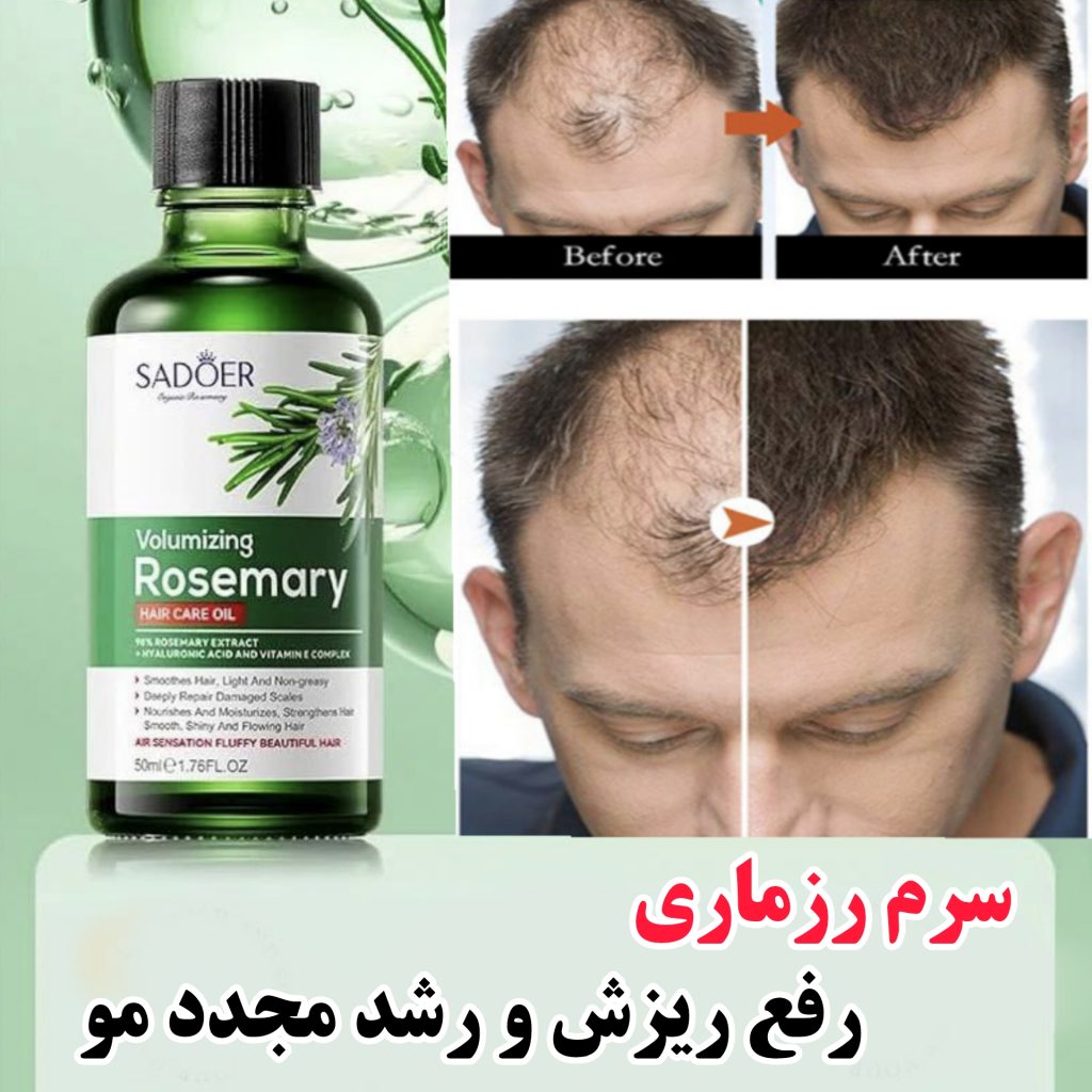 سرم روغن رزماری