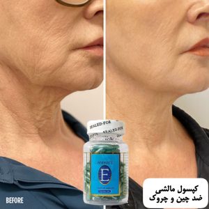 کپسول مالشی رفع چین و چروک
