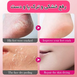 استیک رفع ترک و خشکی کف پا و دست