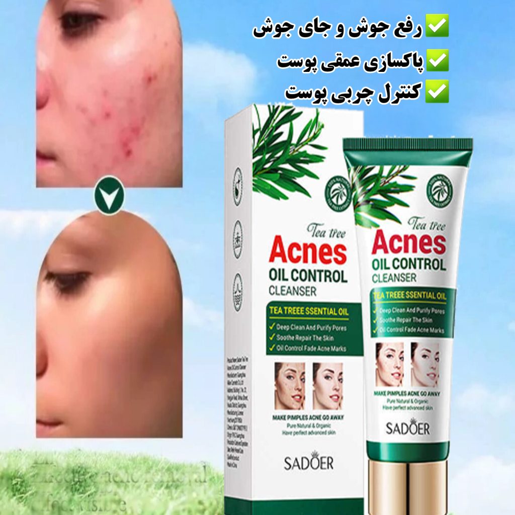 فوم شستشوی ضدجوش و آکنه چای سبز سادور
