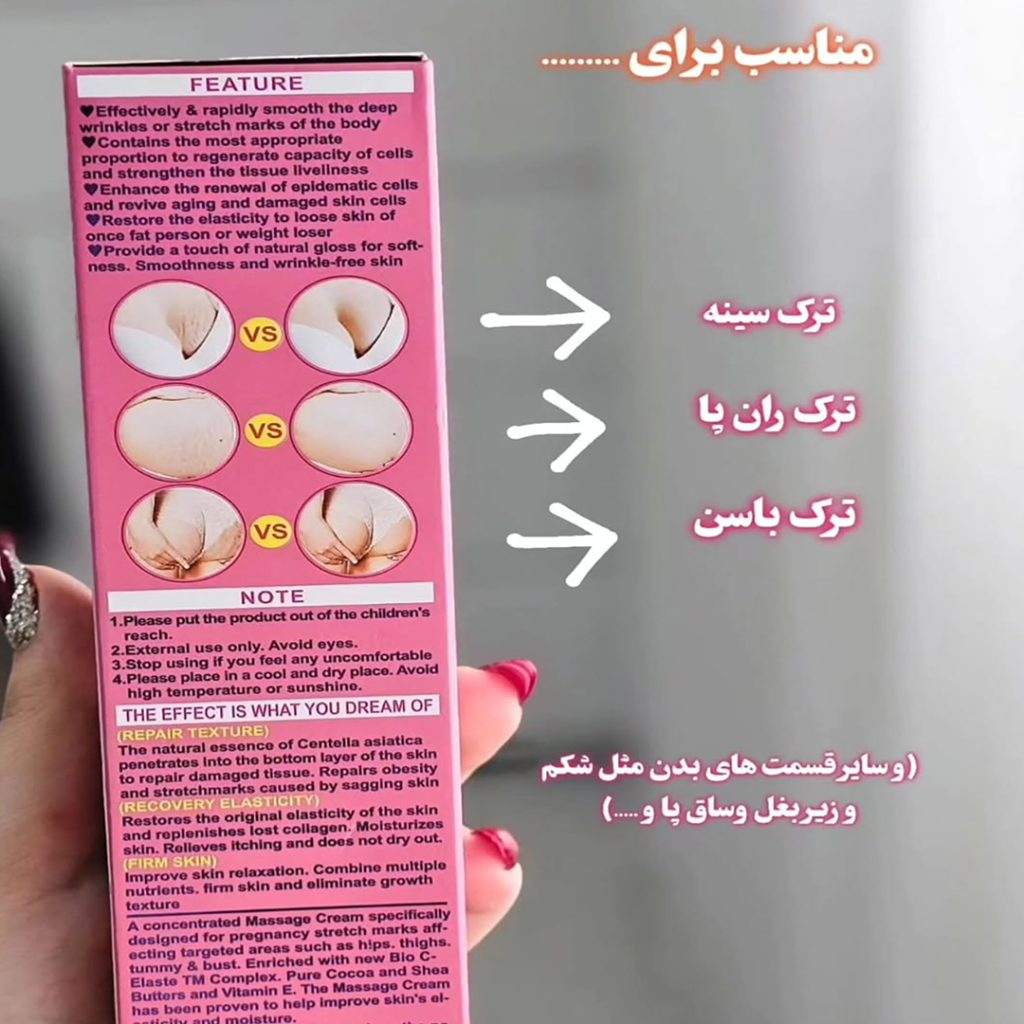 کرم رفع ترک شکم وکالی