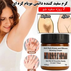 کرم سفید کننده مویام