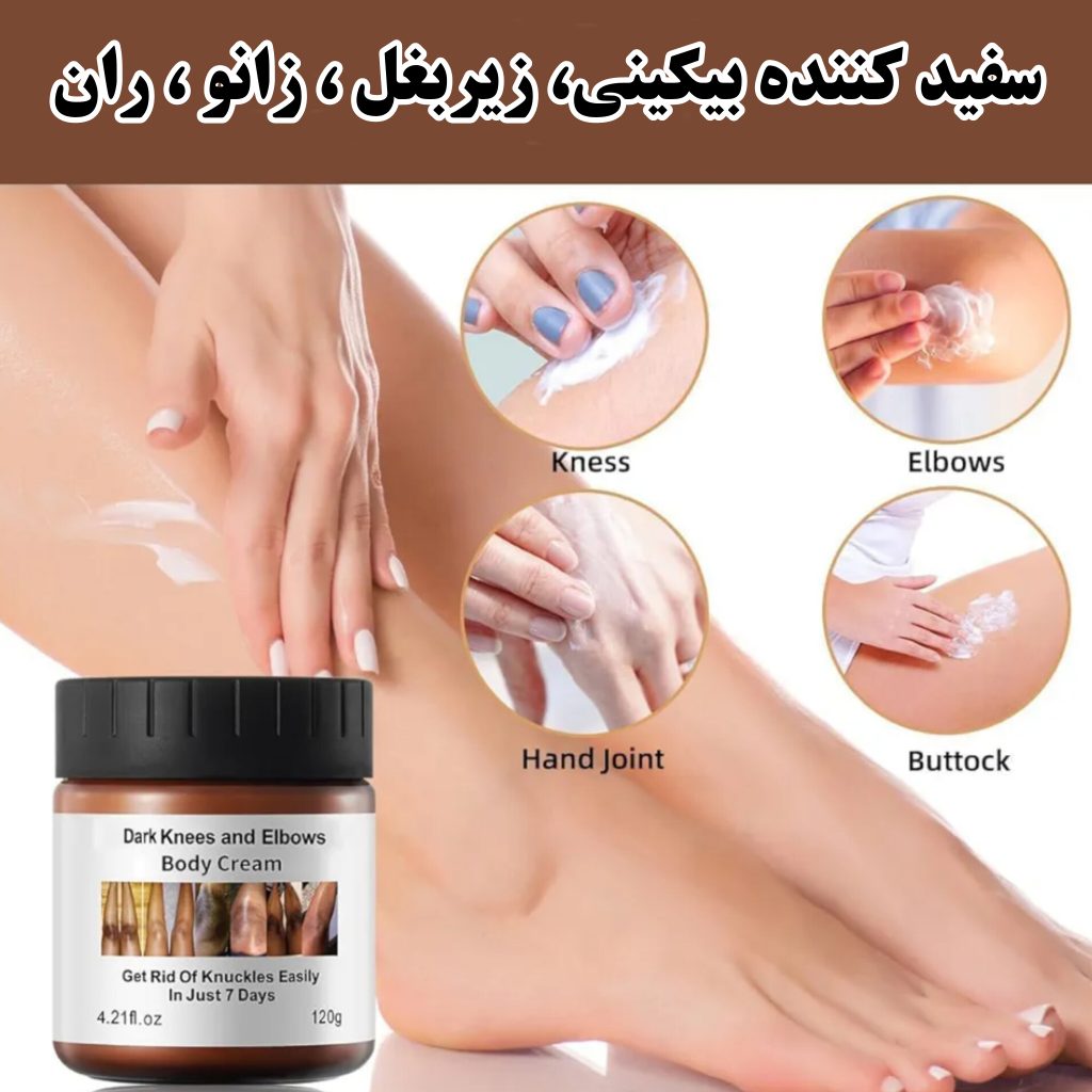 کرم سفید کننده مویام