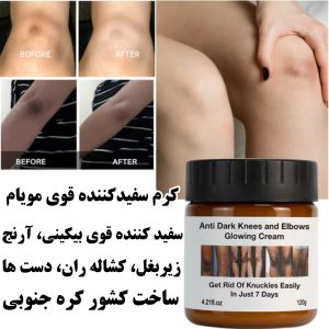 کرم سفید کننده مویام