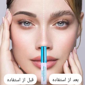 ژل لیفت ابرو گابرینی