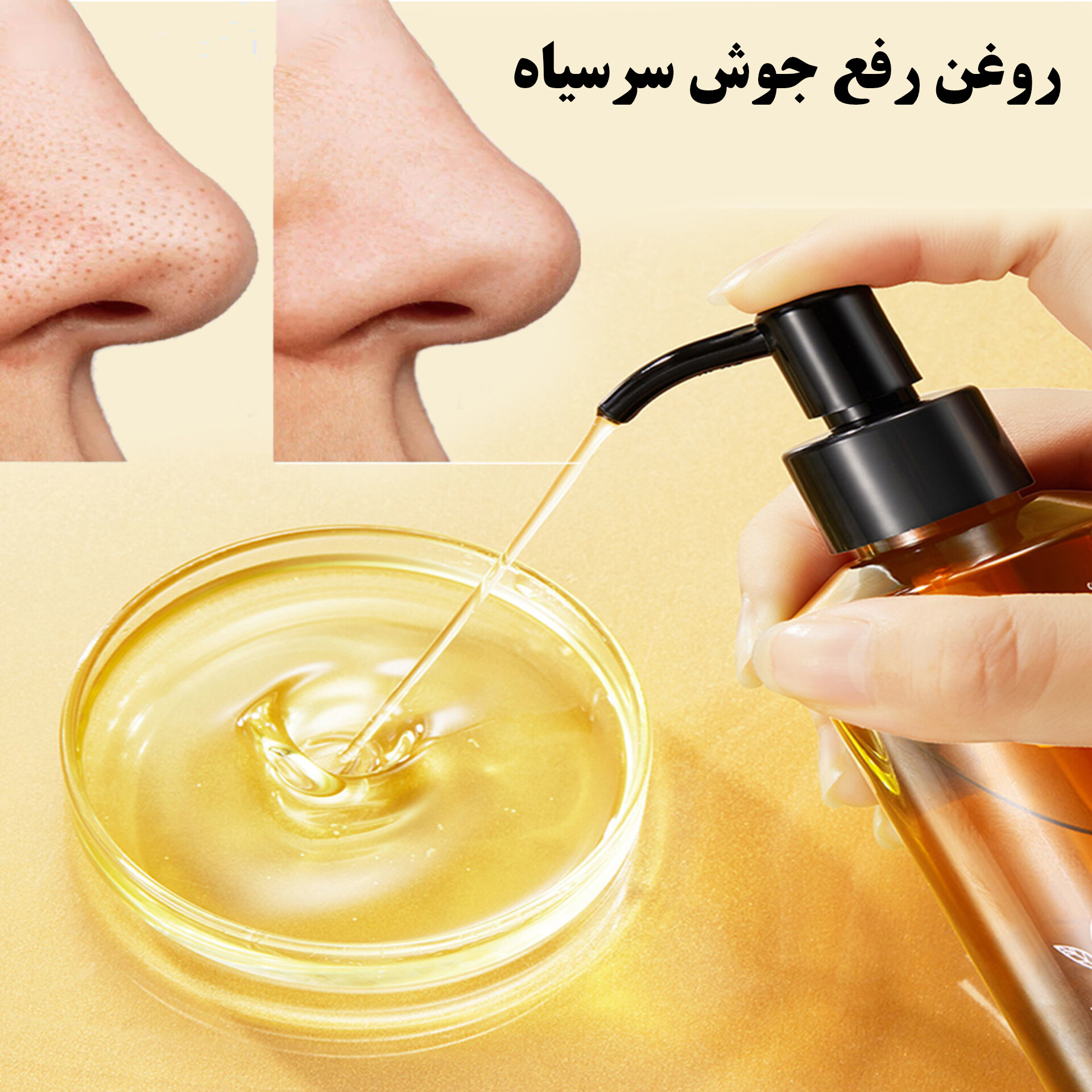 InShot_20251209_075806255 روغن تخلیه جوش سرسیاه و منافذ