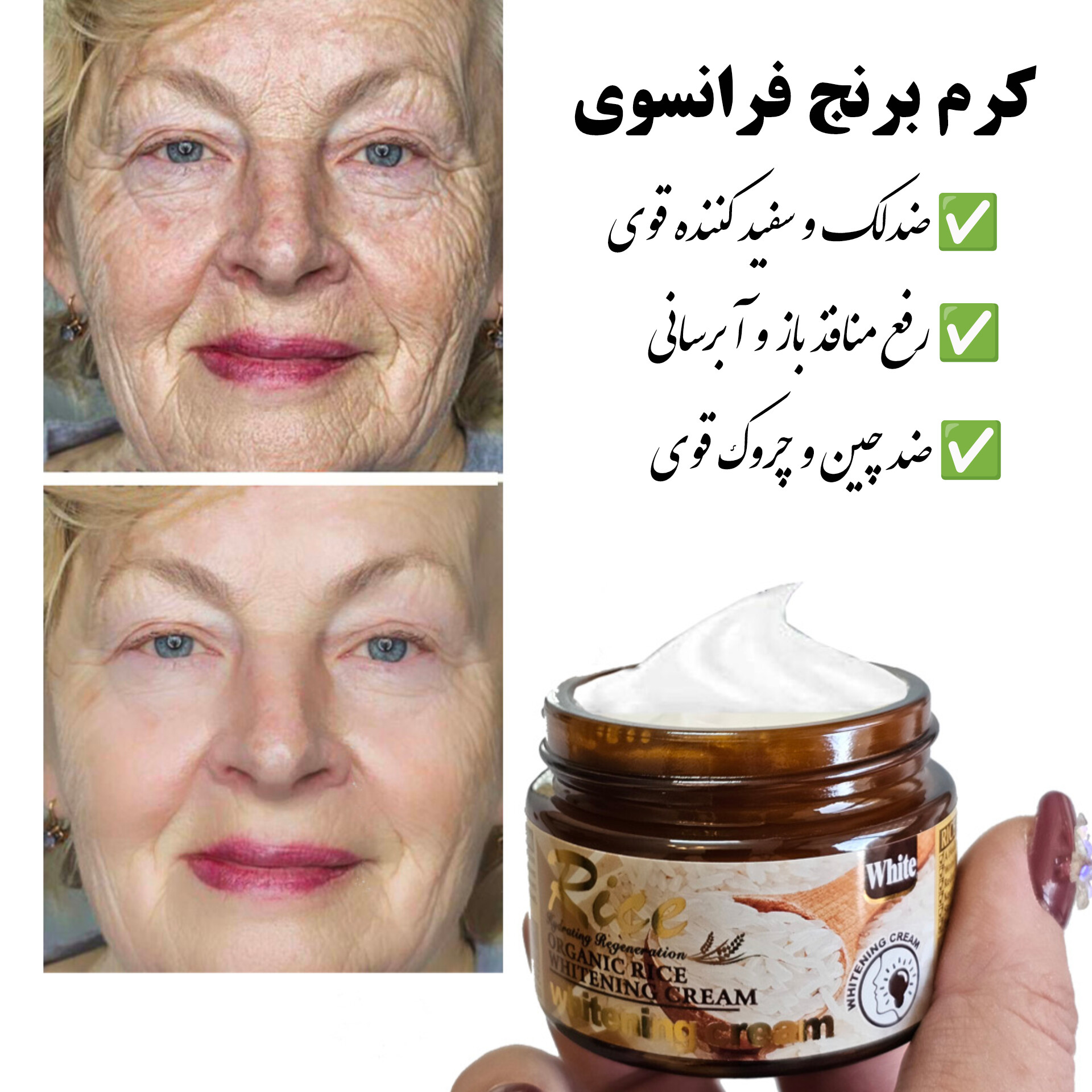 InShot_20260201_174035944 کرم برنج ضدلک و سفیدکننده دائمی وکالی