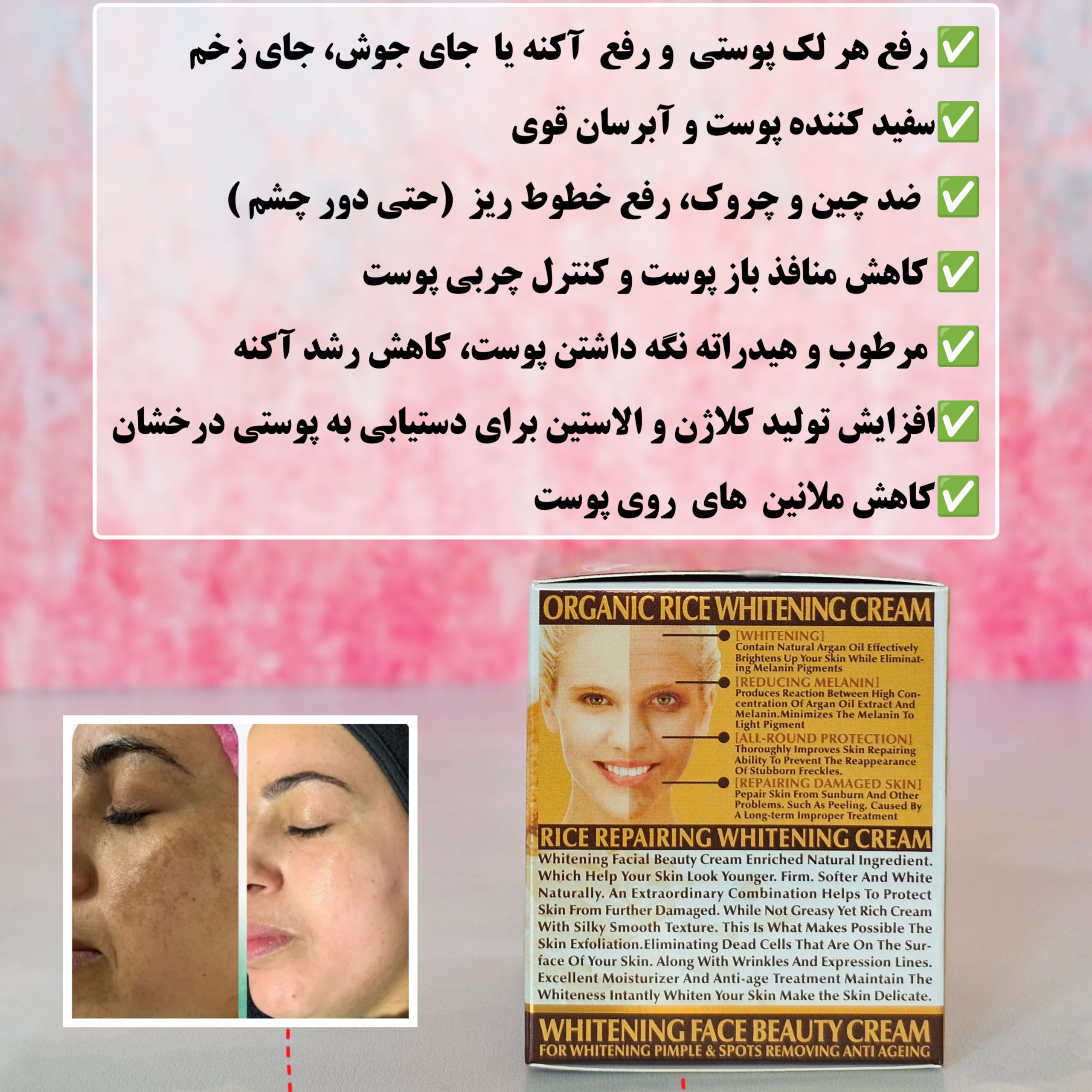 InShot_20260201_174135286 کرم برنج ضدلک و سفیدکننده دائمی وکالی