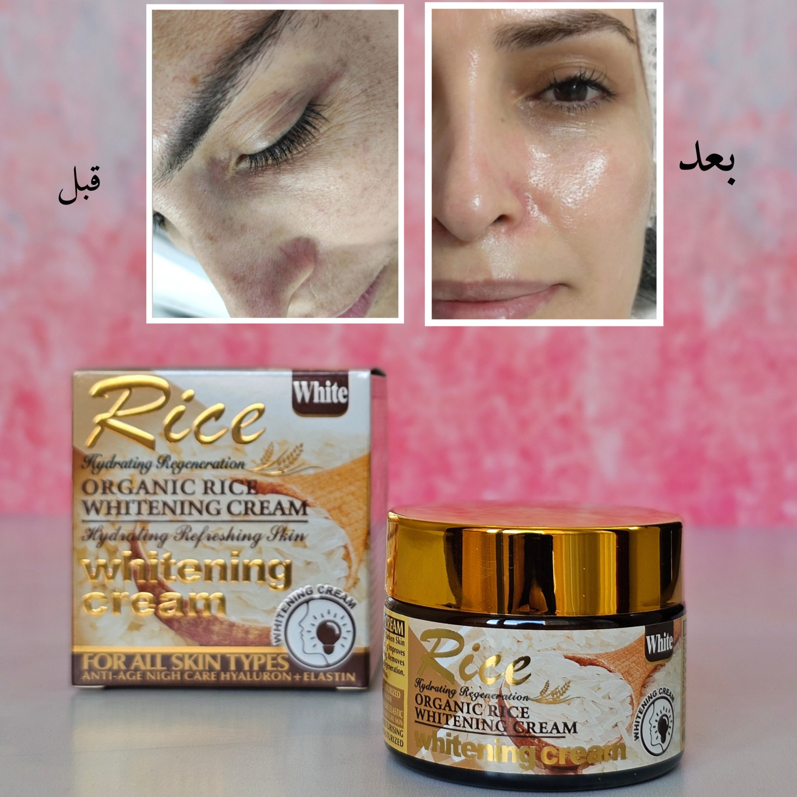 InShot_20260201_174513515 کرم برنج ضدلک و سفیدکننده دائمی وکالی