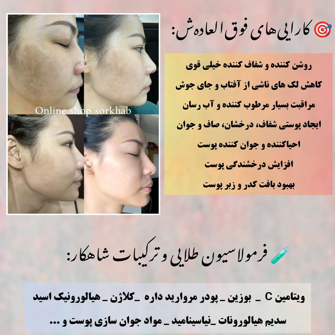 IMG_20260608_102459_715 کرم ژل کپسولی ویتامین سی