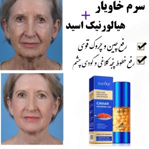 سرم جوانساز خاویار و هیالورونیک اسید سادور