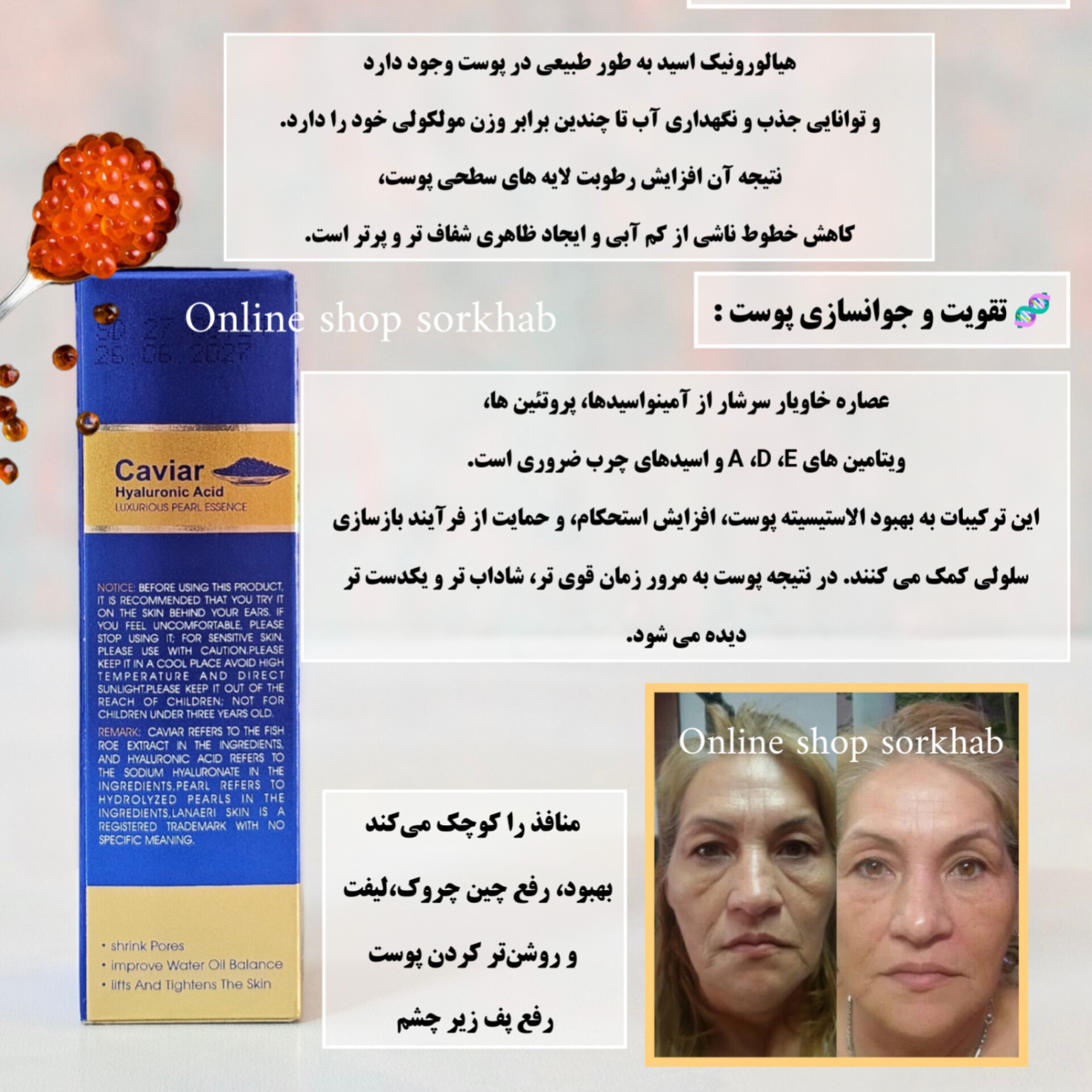 InShot_20260616_110557159 سرم جوانساز خاویار و هیالورونیک اسید سادور