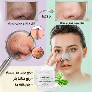 چسب رفع جوش سرسیاه لانبنا