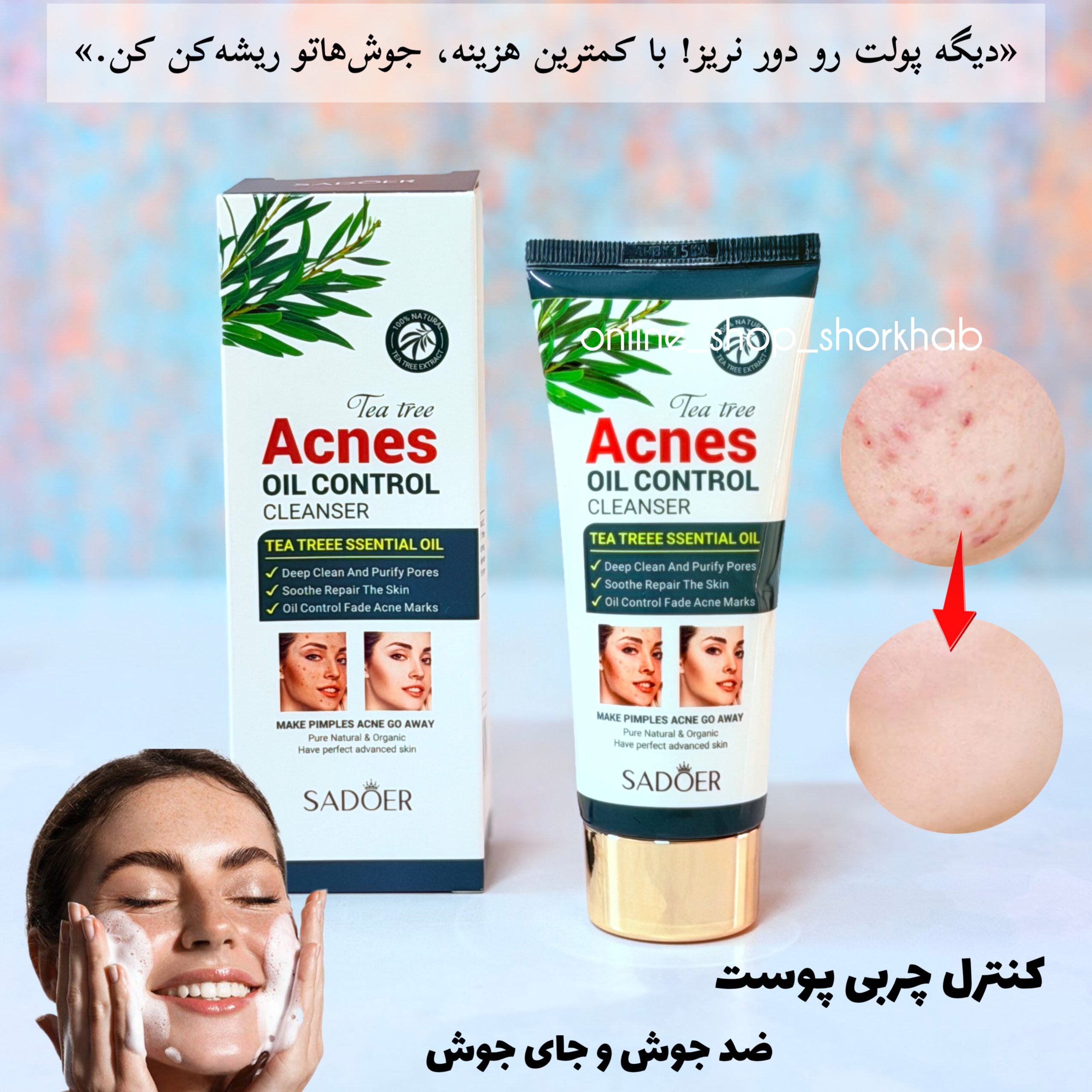 InShot_20260714_194047561 فوم شستشوی چای سبز ضد جوش