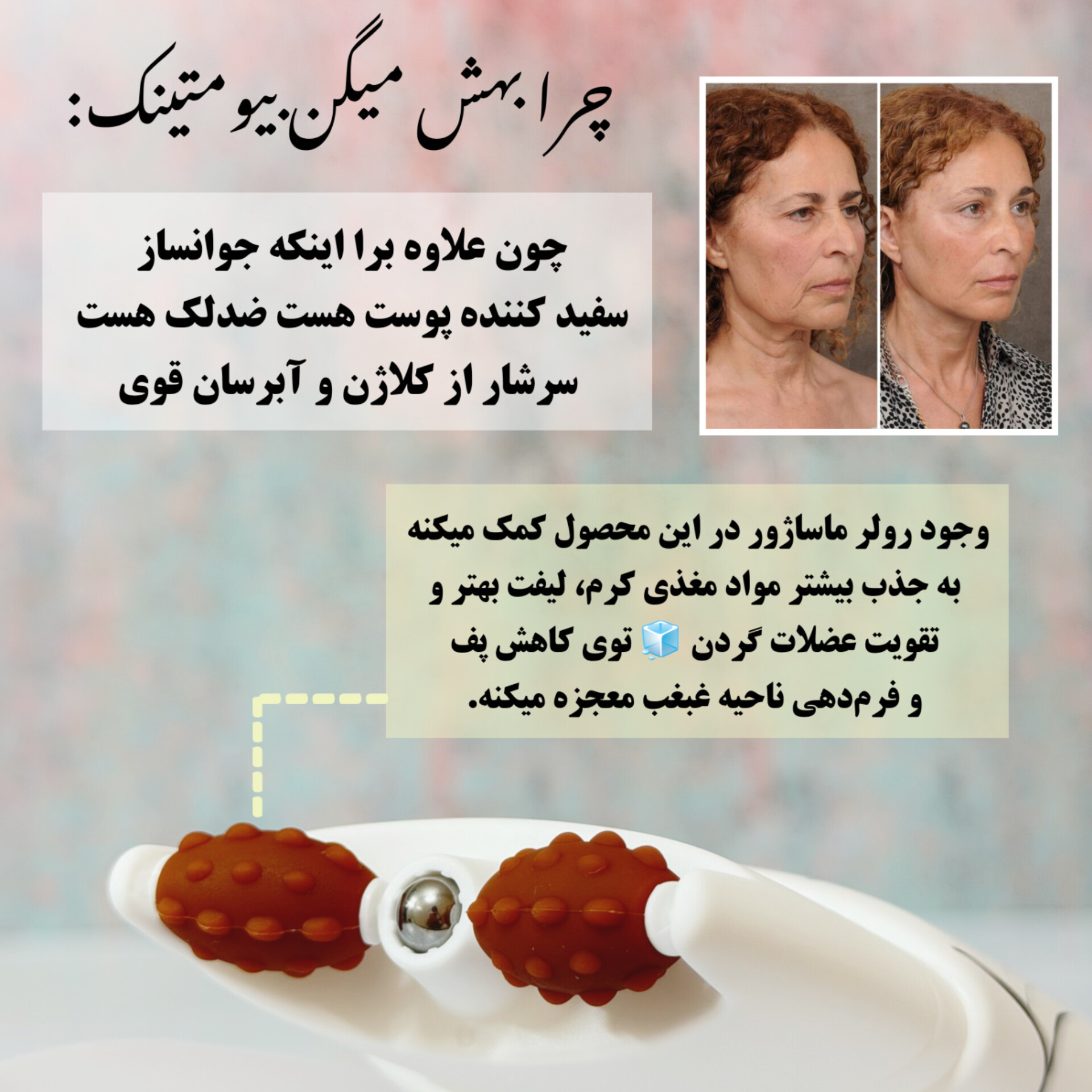 InShot_20260729_171920666 کرم غلطکی رفع غبغب و چین و چروک گردن وکالی
