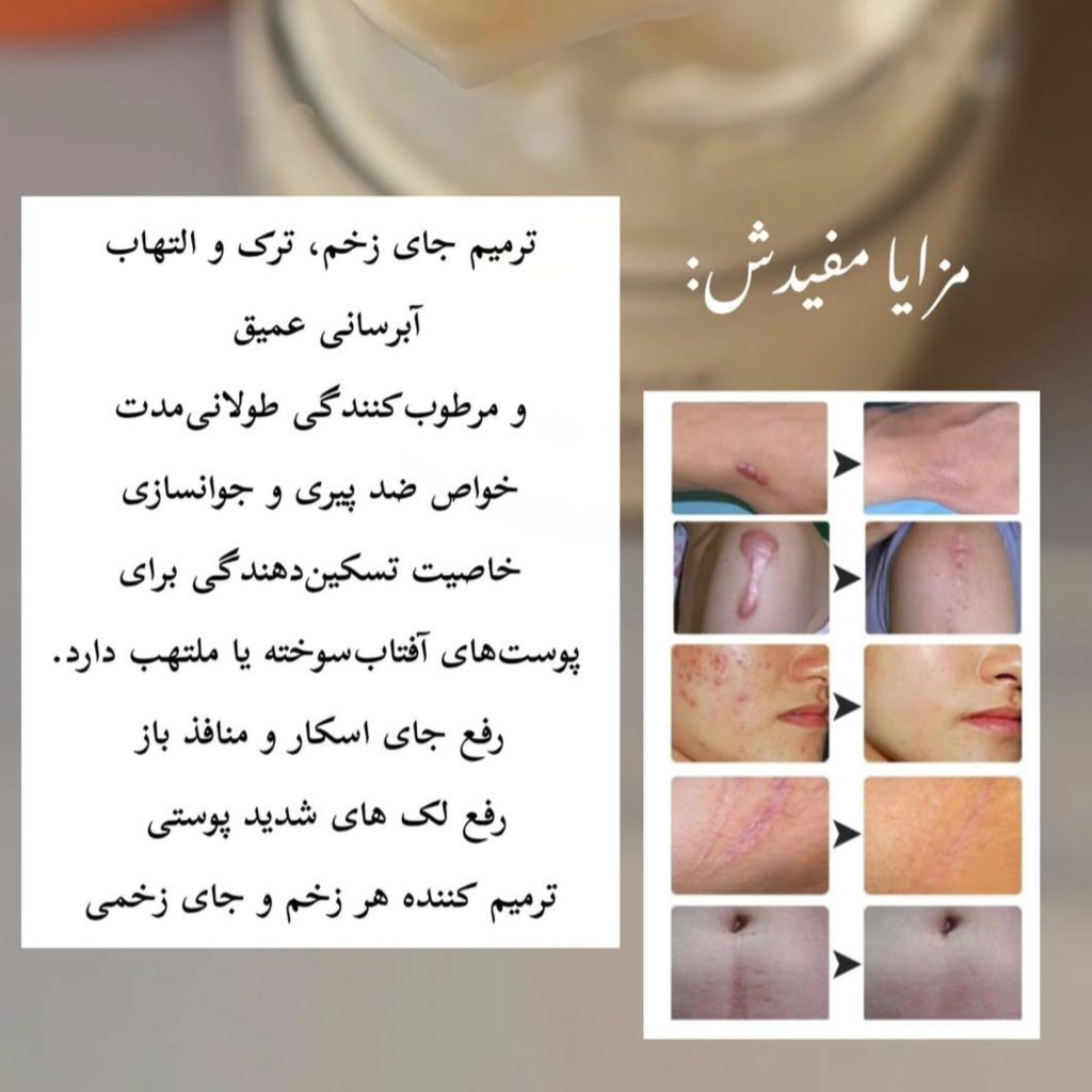 کرم روغن اسب رفع جای زخم و اسکار