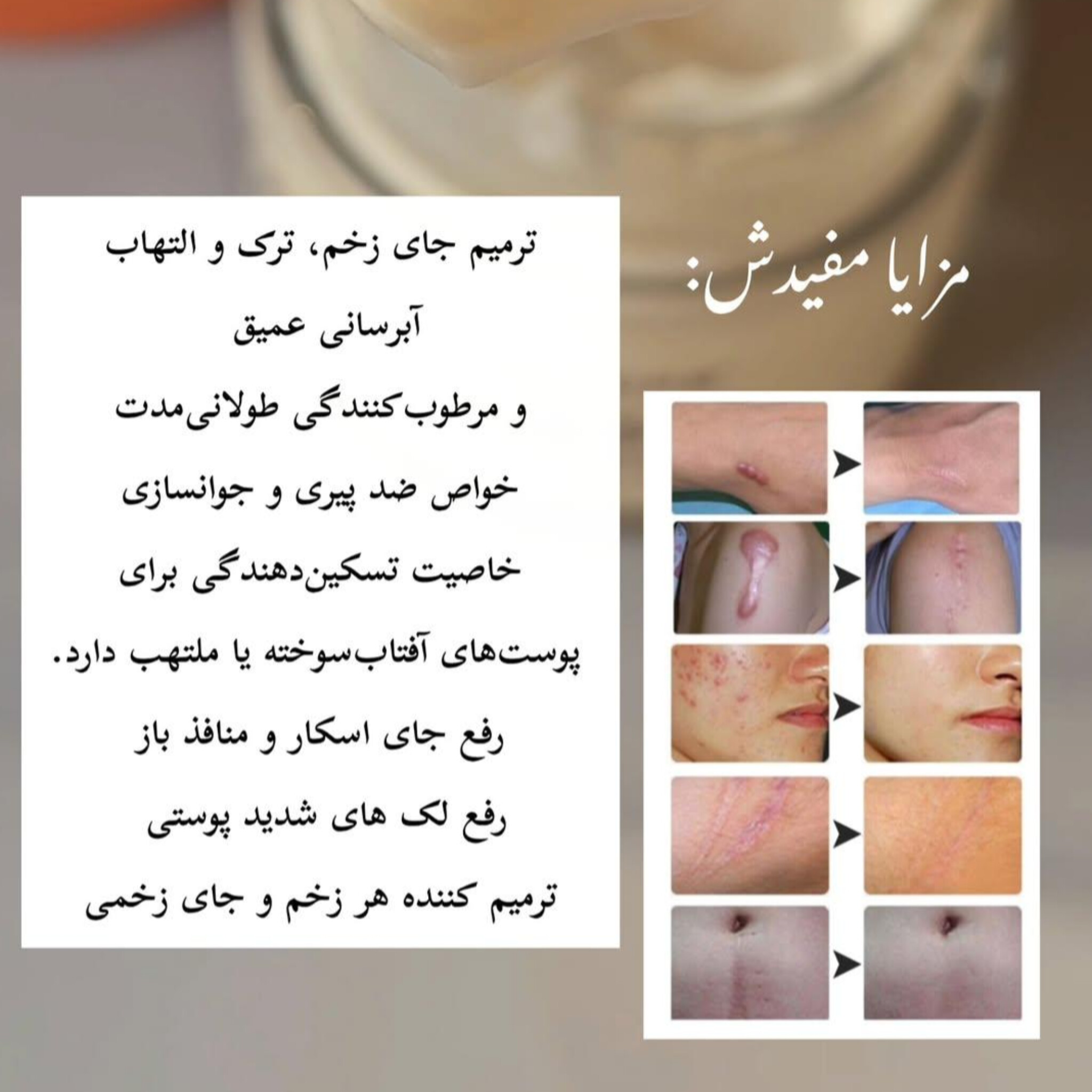 InShot_20260815_193655960 کرم روغن اسب رفع جای زخم و اسکار
