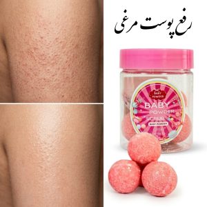 اسکراپ آدامسی سفید کننده رفع پوست مرغی